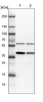 PRPF18 Antibody in Western Blot (WB)