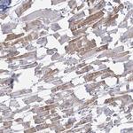 C11orf21 Polyclonal Antibody