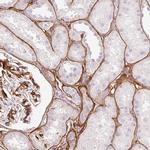 LOXL4 Antibody in Immunohistochemistry (IHC)