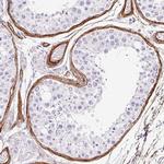 LOXL4 Antibody in Immunohistochemistry (IHC)