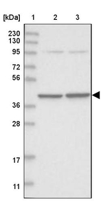 SEPHS1 Antibody in Western Blot (WB)