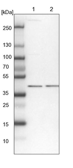 SEPHS1 Antibody in Western Blot (WB)