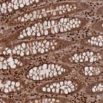 C10orf32 Antibody in Immunohistochemistry (Paraffin) (IHC (P))