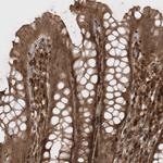 AVPI1 Antibody in Immunohistochemistry (Paraffin) (IHC (P))