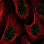 ABRA1 Polyclonal Antibody