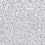 ABRA1 Antibody in Immunohistochemistry (Paraffin) (IHC (P))