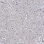 ABRA1 Antibody in Immunohistochemistry (Paraffin) (IHC (P))