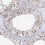 ABRA1 Antibody in Immunohistochemistry (Paraffin) (IHC (P))