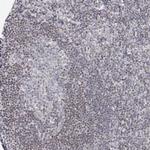 ABRA1 Antibody in Immunohistochemistry (Paraffin) (IHC (P))