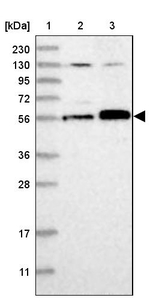 ABRA1 Antibody in Western Blot (WB)
