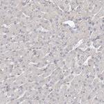 GUCY2C Antibody in Immunohistochemistry (Paraffin) (IHC (P))