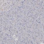 GUCY2C Polyclonal Antibody