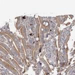 GUCY2C Antibody in Immunohistochemistry (IHC)