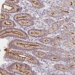 ABHD8 Polyclonal Antibody