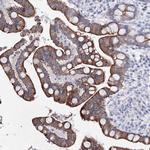 C6orf1 Antibody in Immunohistochemistry (Paraffin) (IHC (P))