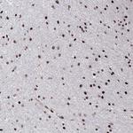 C6orf1 Antibody in Immunohistochemistry (Paraffin) (IHC (P))