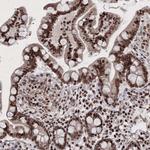 C6orf1 Antibody in Immunohistochemistry (Paraffin) (IHC (P))