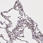 C6orf1 Antibody in Immunohistochemistry (Paraffin) (IHC (P))