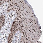 C3orf33 Antibody in Immunohistochemistry (Paraffin) (IHC (P))