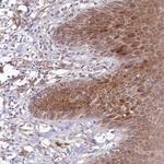 BPIL2 Polyclonal Antibody