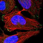 LRCH4 Polyclonal Antibody