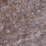 LRCH4 Antibody in Immunohistochemistry (IHC)
