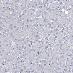 LRCH4 Antibody in Immunohistochemistry (IHC)