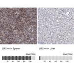 LRCH4 Polyclonal Antibody