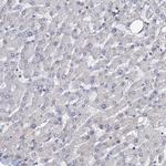 LRCH4 Antibody in Immunohistochemistry (IHC)