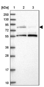 LRCH4 Antibody in Western Blot (WB)