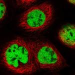 QRICH1 Polyclonal Antibody