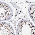 QRICH1 Antibody in Immunohistochemistry (IHC)