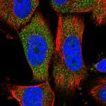 MOCS2 Polyclonal Antibody