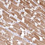 INPP4B Antibody in Immunohistochemistry (Paraffin) (IHC (P))