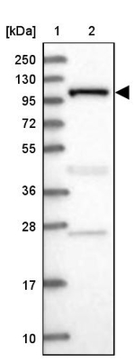 INPP4B Antibody in Western Blot (WB)