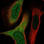 SH3TC2 Polyclonal Antibody