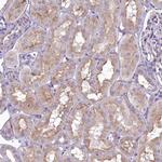 SH3TC2 Antibody in Immunohistochemistry (Paraffin) (IHC (P))