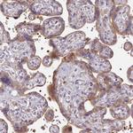 SH3TC2 Antibody in Immunohistochemistry (Paraffin) (IHC (P))