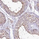 SH3TC2 Antibody in Immunohistochemistry (Paraffin) (IHC (P))