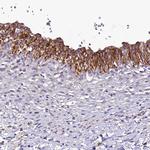 SH3TC2 Antibody in Immunohistochemistry (Paraffin) (IHC (P))
