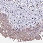 SHROOM1 Antibody in Immunohistochemistry (Paraffin) (IHC (P))