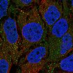 SHROOM1 Polyclonal Antibody