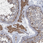 BCS1L Antibody in Immunohistochemistry (IHC)