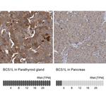 BCS1L Antibody in Immunohistochemistry (IHC)