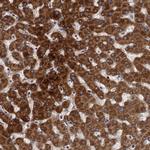 BCS1L Polyclonal Antibody