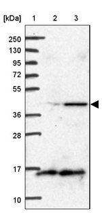 BCS1L Antibody in Western Blot (WB)