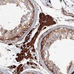 EXOC1 Polyclonal Antibody