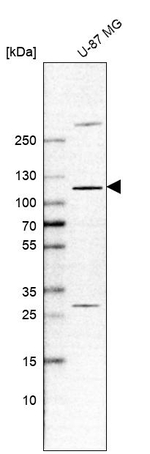 EXOC1 Antibody in Western Blot (WB)