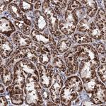 ACAD9 Antibody in Immunohistochemistry (Paraffin) (IHC (P))