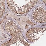 MAML3 Antibody in Immunohistochemistry (Paraffin) (IHC (P))